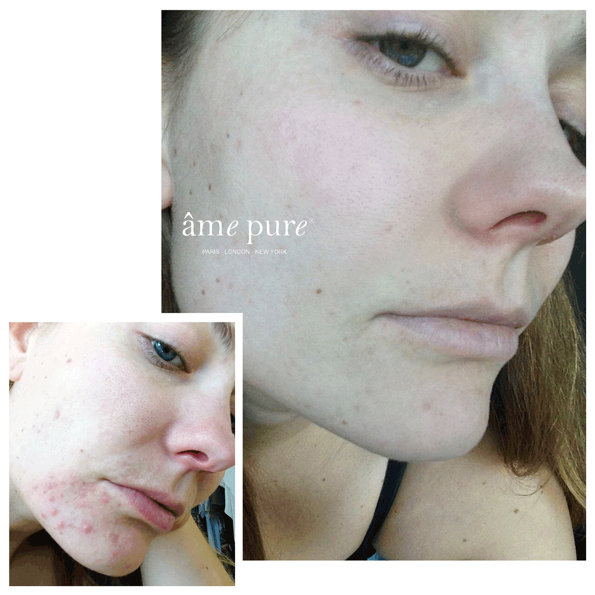 CIT Face Roller PLATINUM