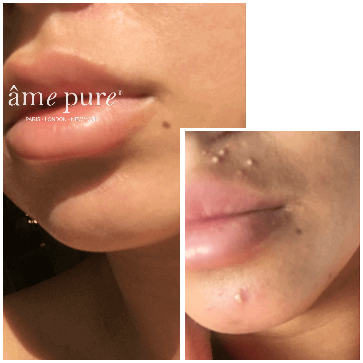 CIT Face Roller PLATINUM