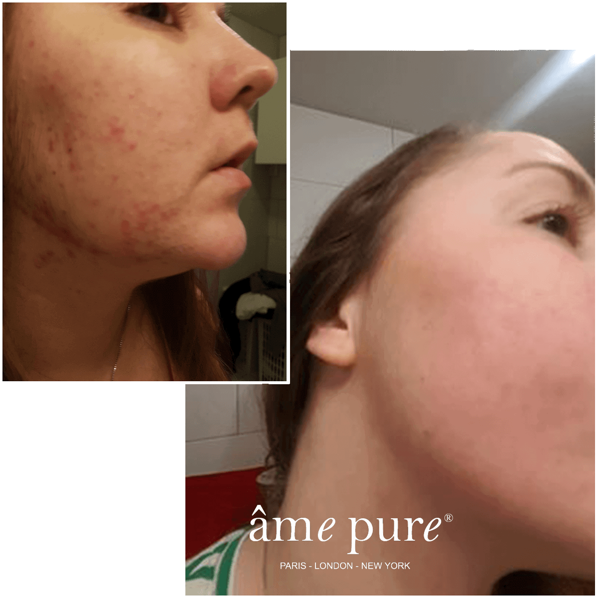 CIT Face Roller PLATINUM