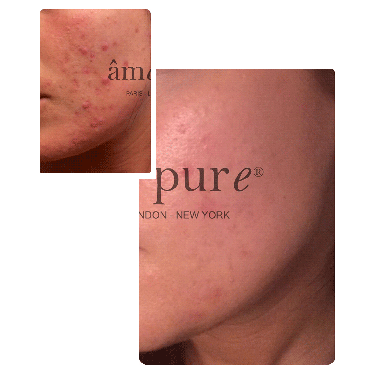 CIT Face Roller PLATINUM