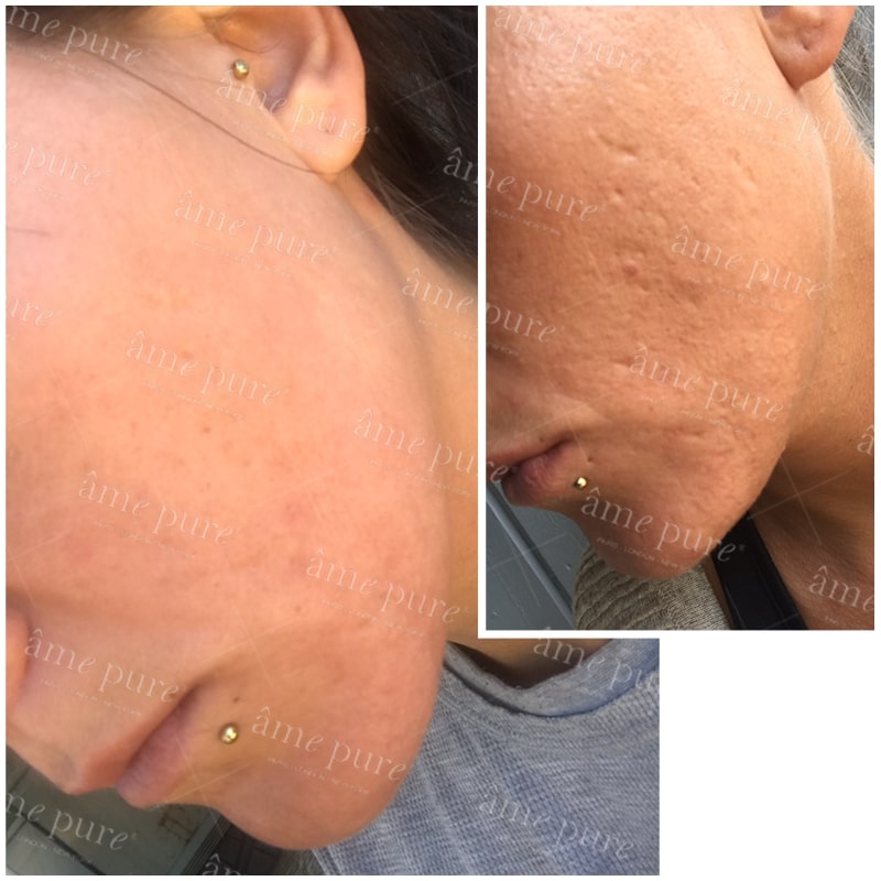2 für 1 | CIT Face Roller PLATINUM