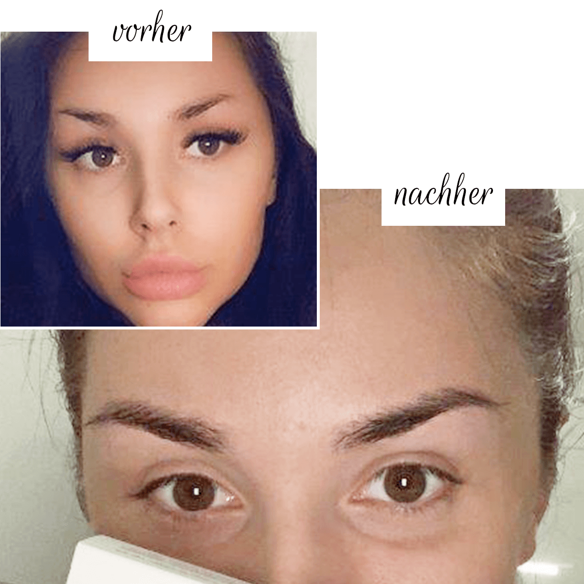 Brow Boost™ |  Augenbrauenserum